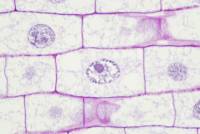 Mitose dans une racine de Blé (prophase) x200